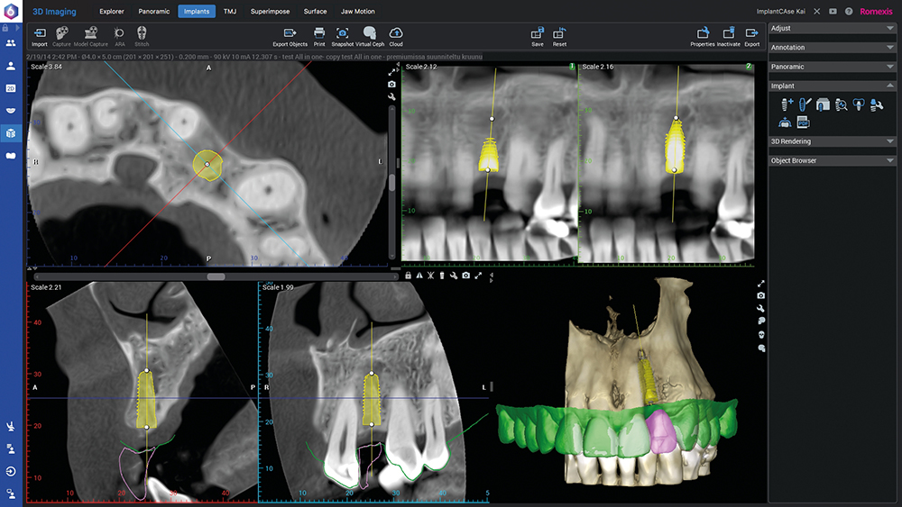 Wir  sind seit 2006 für die 3D Implantatplanung zertifiziert.